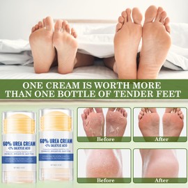 Pack of 2 Hydrating Foot Cream, Anti-Cracking Foot Cream, Moisturising Foot Care Cream, Anti-Crack Foot Cream, Feet Hand Skin Protection Cream, Repair Cream for Cracked Heels, Cracked Skin Repair