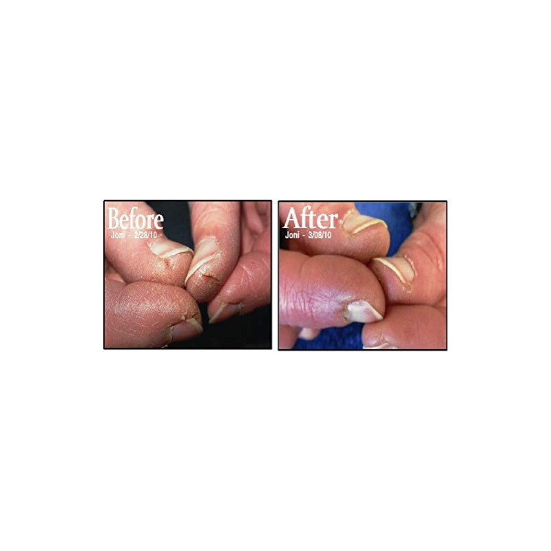 HerillaFingerHydration (4 tubes)