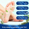 Exfoliante Para Pies Con Urea 60% Y Ácido Salicílico Coco