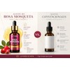 Aceite Rosa Mosqueta Puro Perennis Facial Hidratante Regenerador Piel Estrías
