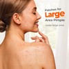 Large Pimple Patches for Face, 7 Sizes XL Acne Patches,