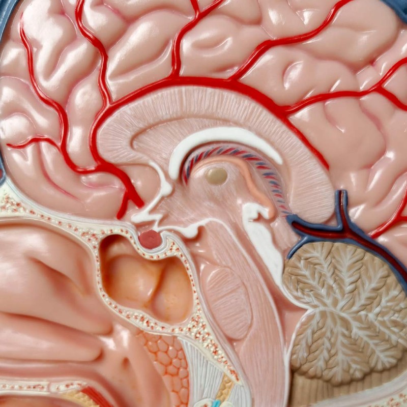 EVOTECH SCIENTIFIC Human Half Head Superficial Neurovascular Model with Musculature,