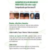 NORA ROSS Shampoo de Ajo Nora Ross 100% Original.Combate caida