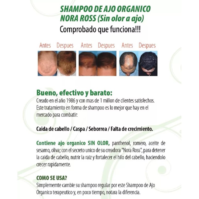 NORA ROSS Shampoo de Ajo Nora Ross 100% Original.Combate caida