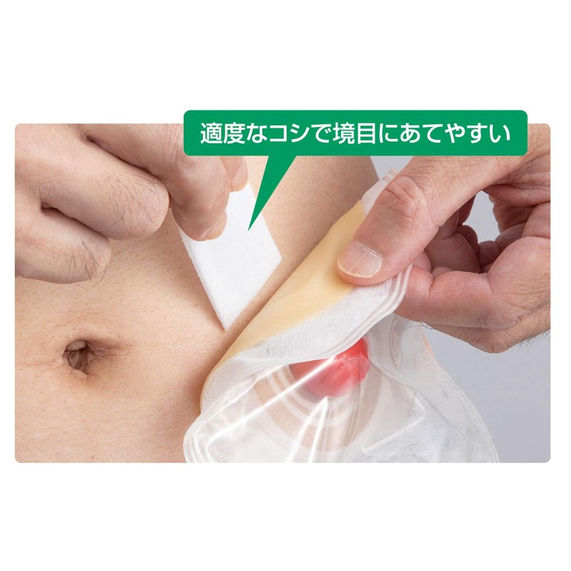 Smooth Remover 19813 Wipe Sheet 50 Iri Stoma Care Products