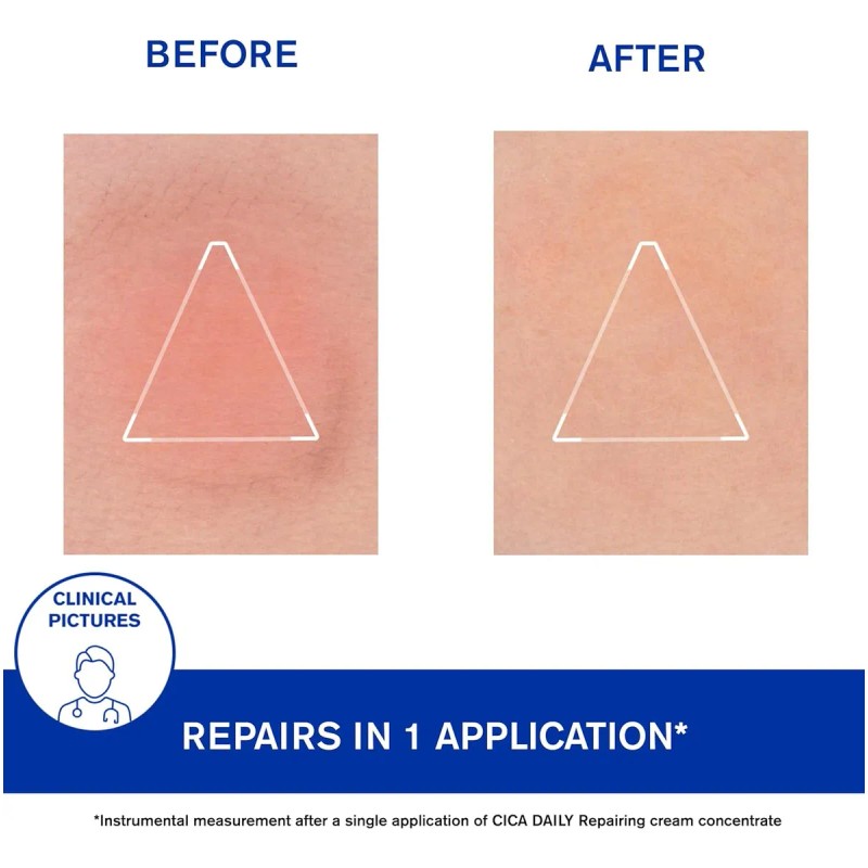 Uriage Cica-daily - Gel Reparador Para La Cara | Hecho