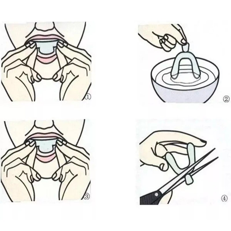 Mafab Guardas Dentales Gel Moldeables Protectores Bucales 2pz F