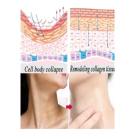 Crema Reafirmante Adelgazante Cuello Papada Lifting Natural                                                                                           