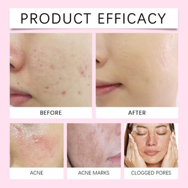 Dark Spot Corrector,Dark Spot Remover,Sun Spots Remover for Face,Hyper/Pigmen/Tation Treatment,D/ark Sp/ot R/emover for Fa/ce,Pigmentation Removal Cream,Age S/pot R/emover for F/ace,D/ark S/pot Serum