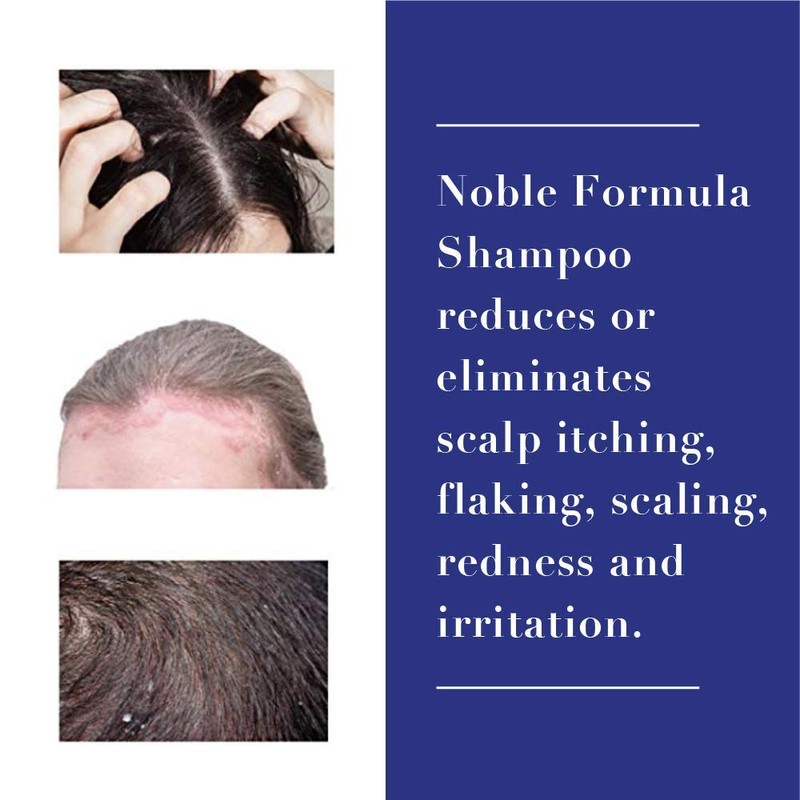 Noble Formula Shampoo with 2% Pyrithione Zinc (ZnP), 8 oz