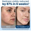Clean Skin Club Clean Toalla Pequeña (1 pack)