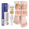 Ungüento Para Hongos En Las Uñas Tratamiento Efectivo 30g