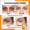 2Pcs Crema Contorno De Ojos Y Herramienta Facial GuaSha