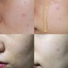 Labonita V-Line Lifting Pack 50ml / 라보니따 브이라인 리프팅 팩
