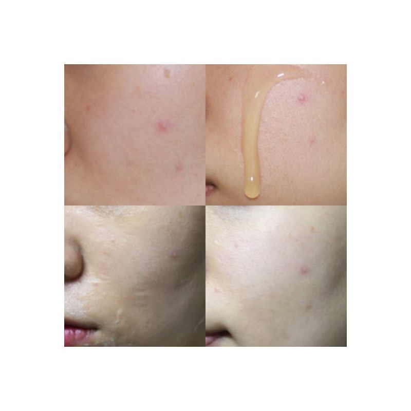 Labonita V-Line Lifting Pack 50ml / 라보니따 브이라인 리프팅 팩