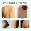 Crepey Skin Repair Tratamiento Crema (1PCS)