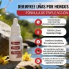 Solución Antifúngica Para Uñas, Pies Y Manos 15 Ml Blanco