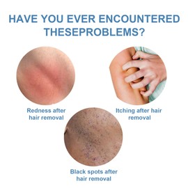 2 Pcs Facial Hair Stop Serum, Facial Hair Removal Treatment, Facial Hair Natural Treatment At Home, Facial Hair Removal Serum Inhibitor, Hair Removal Serum For Face & Body