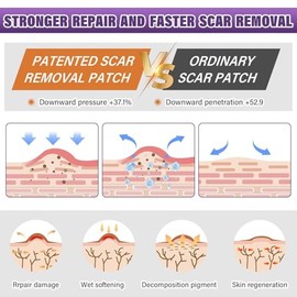 Hojas de silicona para cicatrices, cinta de silicona para cicatrices, tiras de silicona para eliminación de cicatrices para cirugía, cesárea, abdomino