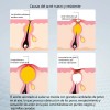 Crema Reparadora Facial 20g, Adecuada Para Piel Con Acné