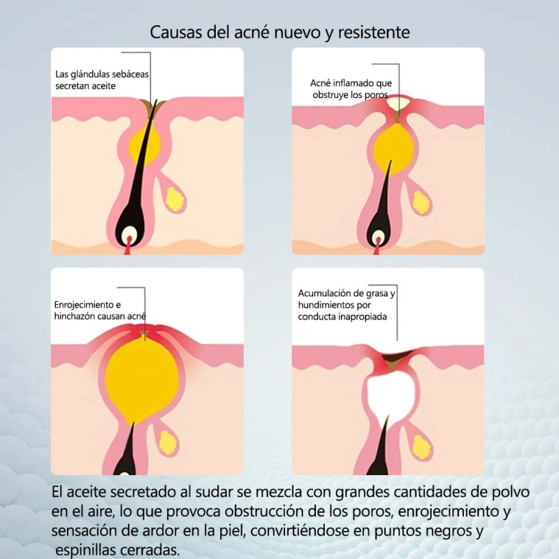Crema Reparadora Facial 20g, Adecuada Para Piel Con Acné