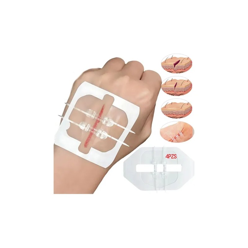 Tiras De Cierre Heridas De Emergencia,vendaje Puntada 4pcs