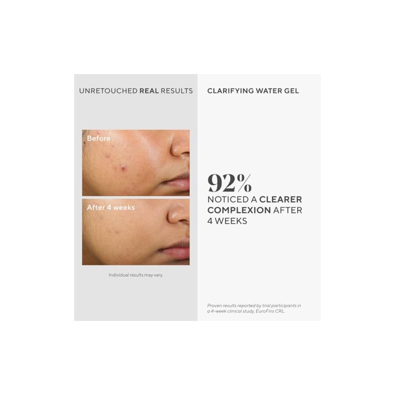 Murad by Murad, Clarifying Water Gel -60ml/2oz