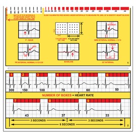 R-CAT for Arrhythmias EKG Pocket Reference Guide – Contains Literally Every EKG Rhythm Known - Great Study Booklet for EKG Interpretation - Cardiac Rhythm Interpretation Made Easy