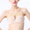 Breast Implant Stabilizer Band 3D Breast Shaping Prevent Outgrowth Side