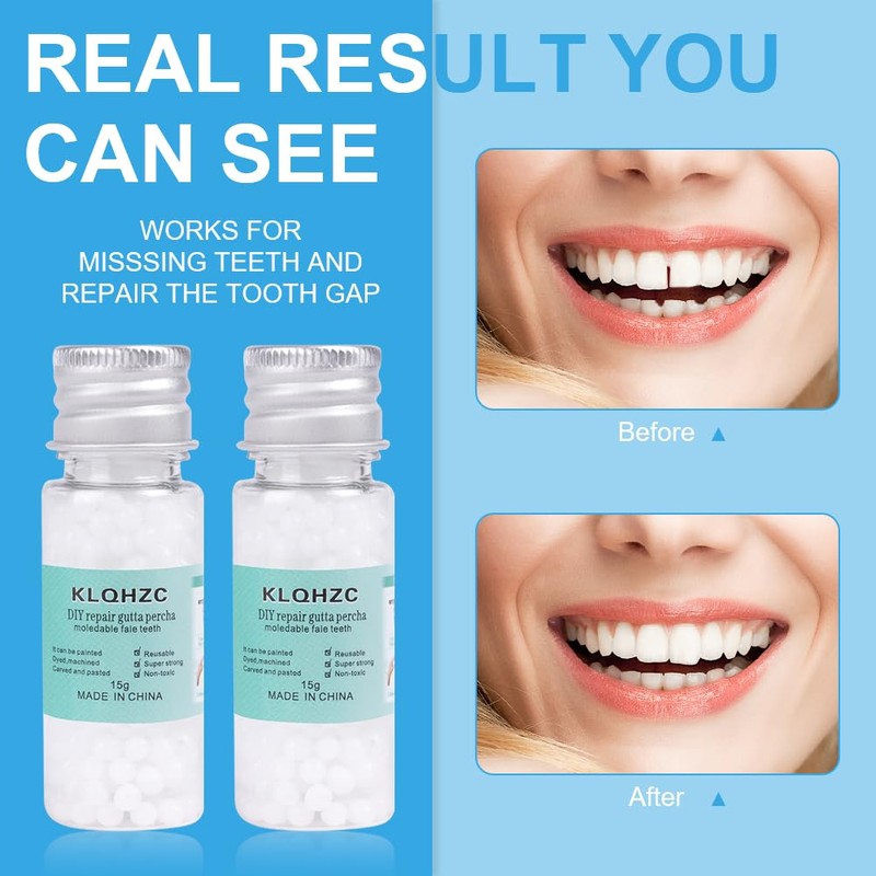 ACWOO Tooth Filling Repair kit, 30ml Temporary Tooth Kits with