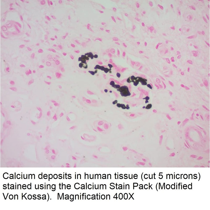 Tyr Scientific LLC Calcium Stain Kit (Modified Von Kossa), 125ml