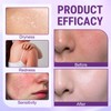 2PCS Biotin 10-in-1 Skin Restoration Cream, Professional Skin Treatment Cream,