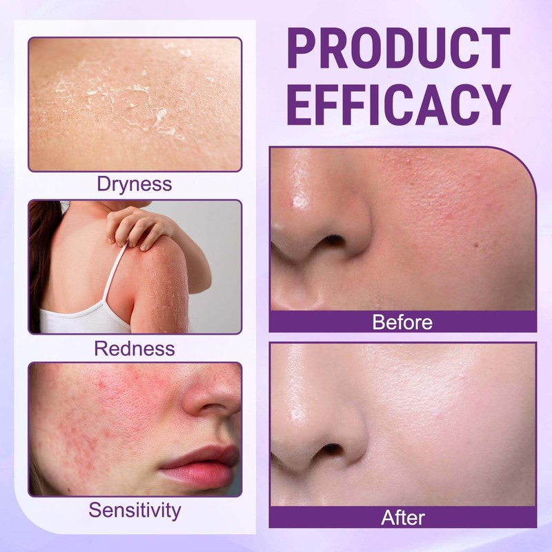 2PCS Biotin 10-in-1 Skin Restoration Cream, Professional Skin Treatment Cream,