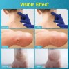 Líquido Para Verrugas 30 Ml - Eliminación Rápida