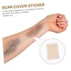 KOMBIUDA Waterproof Skin Concealer Sticker Scar Cover Tape for Birthmarks