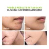 pure.tiful 2% Salicylic Acid (BHA) Serum for Acne & Blackheads