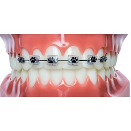 Snapcaps Braces Bumper Cover, Orthodontic Bracket Wax Substitute, Alternative Snap-on Braces Guard Braces Accessories 10 pack (Paw Print)