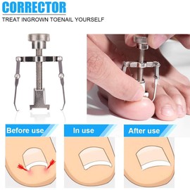 INSGB Precision Toenail Clippers for Thick or Ingrown Toenails - Thick Toenails (5 Pcs Set with Nail Correction Tool in Gift Box)