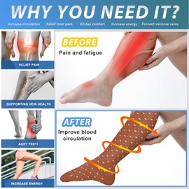 Compression Socks for Women and Men, Knee High Support Socks for Travel,Nurses,Flying