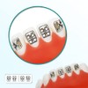 Protector Soportes dentales, 200 unidades/10 paquetes de Brackets de acero