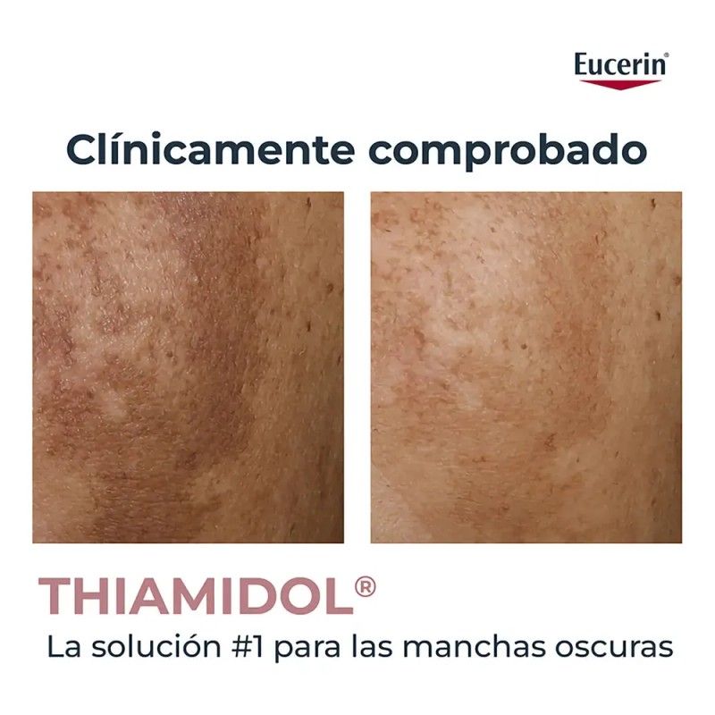 Crema Corporal Antipigmentaria Eucerin Para Zonas Específica 200mL