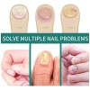 *sérum Fortalecedor De Uñas, Tratamiento Nutritivo Y Reparad