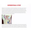 ORGANIC VITAMINS QUISTE TESTICULAR ROMOVEDOR - NO MAS DOLOR -
