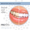 PRO-SYS Whitening Strips Kit, Sensitive Teeth Whitening Tray, Stain Remover,