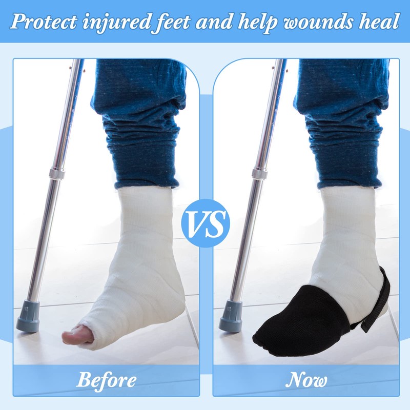 Geyoga 2 Pack Cast Socks Toe Cover for Leg, Ankle