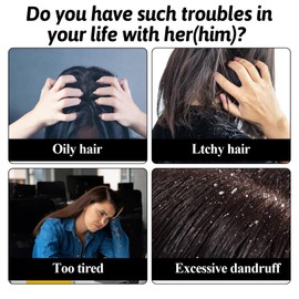 Tyqour 3Pcs Dandruff Comb Psoriasis Comb Scalp Sweep Detoxing Comb Stainless Steel Fine Tooth Comb Dandruff Removal Comb Multifunctional Hair Grooming Tool for Women Men Scalp Massage Refreshing