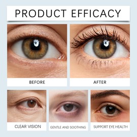 Lanolin Free Eyelid Ointment – Eyelid Repair Eye Cream – Soothing & Hydrating Care for Dry, Red & Flaky Eyelids – Barrier Support Moisturising Eye Cream for Sensitive Skin, Day & Night Use