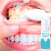 LANTHOME White Foam Teeth Whitening Products (3PCS) Easy to Use