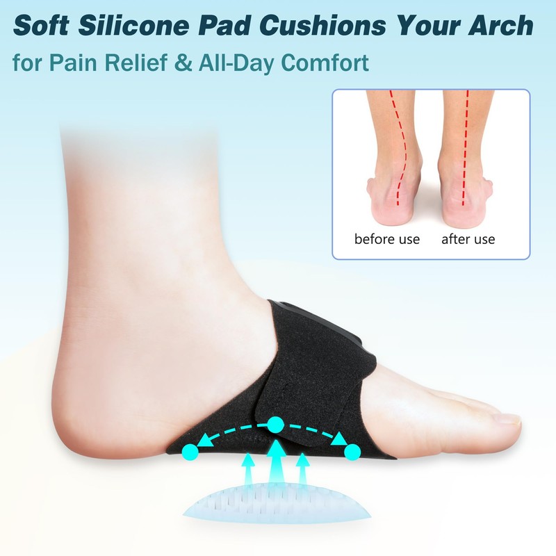 TOMUST Arch Support Bands (Pair) for Plantar Fasciitis Relief –