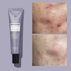 아나시스 아클레온 청소년 사춘기 성인 여드름 스킨케어 화장품 3종 세트 Anasis Acrileon Youth Adolescent Adult Acne Skincare Cosmetic 3-Product Set